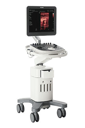 飞利浦彩超诊断仪